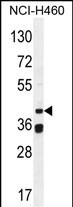 Rabbit Polyclonal Antibody to BSCL2 (N-term)