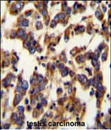 Rabbit Polyclonal Antibody to BSCL2 (N-term)