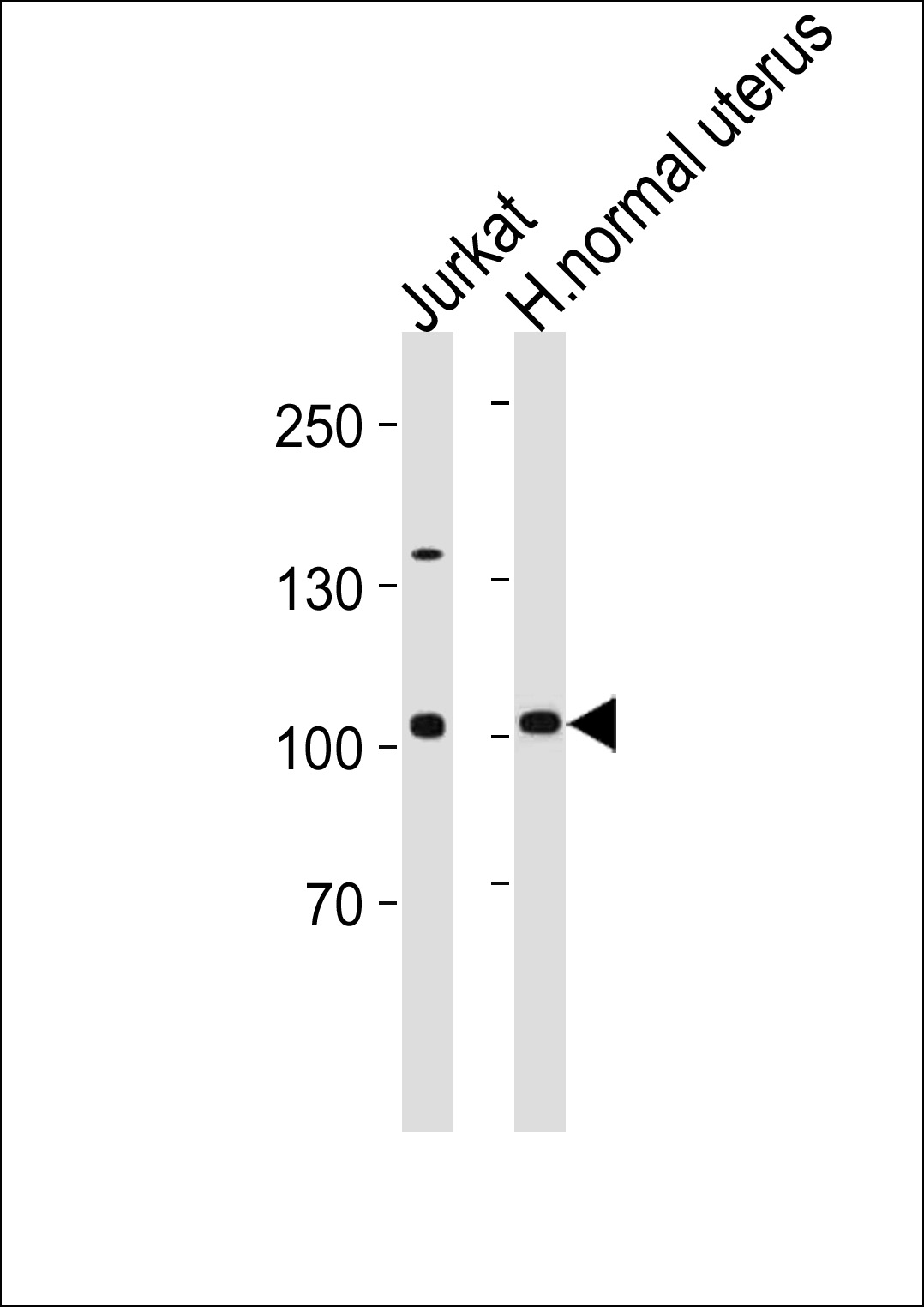 Rabbit Polyclonal Antibody to TERT 