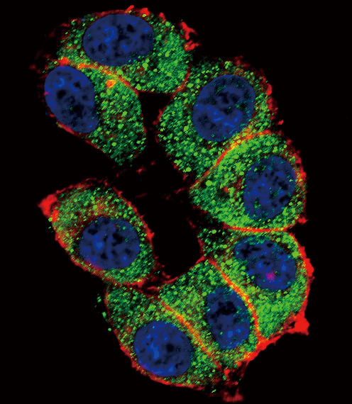 Rabbit Polyclonal Antibody to TERT 