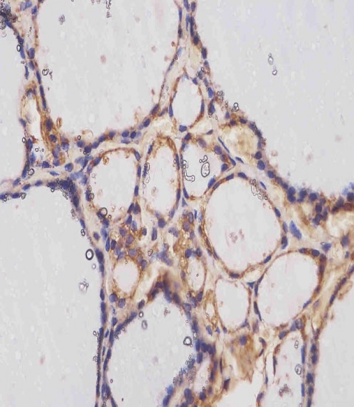 Rabbit Polyclonal Antibody to TERT 