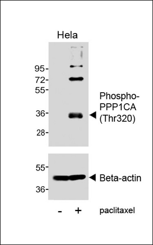 Phospho-PPP1CA (Thr320)