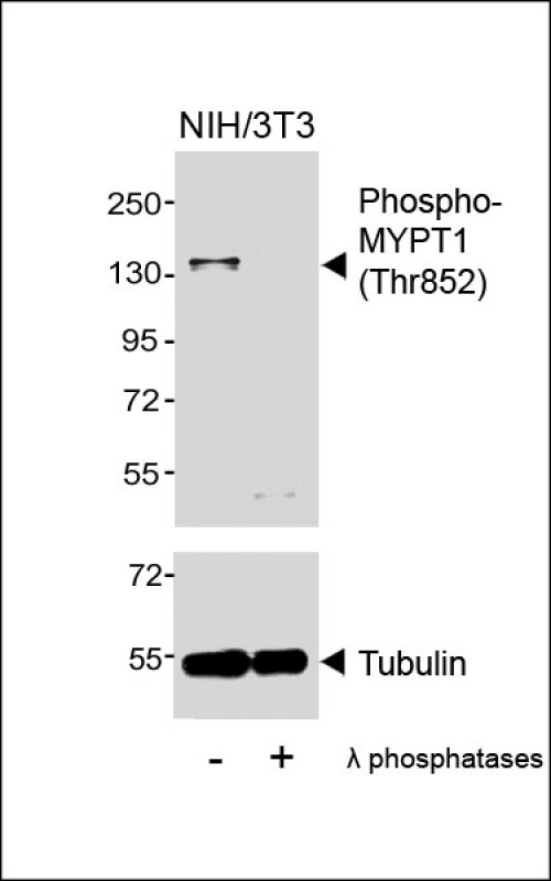 Phospho-MYPT1 (Thr852)