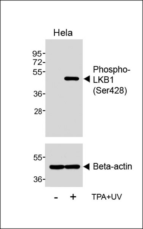 Phospho-LKB1 (Ser428)
