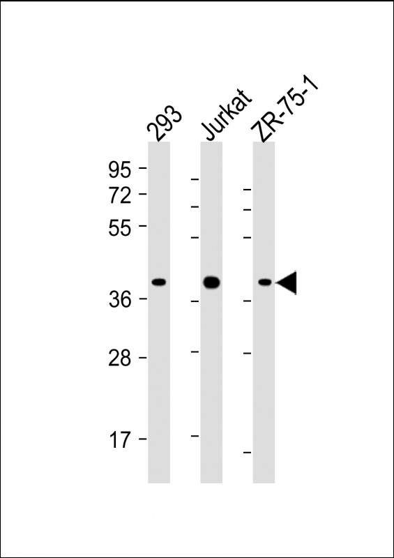 HIF1AN