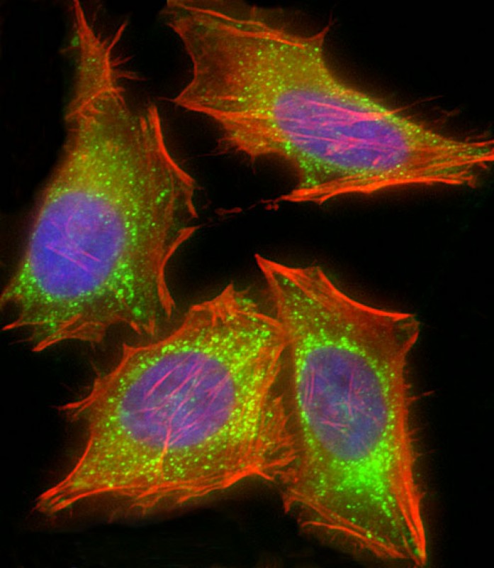 Mouse Monoclonal Antibody to HIF1AN