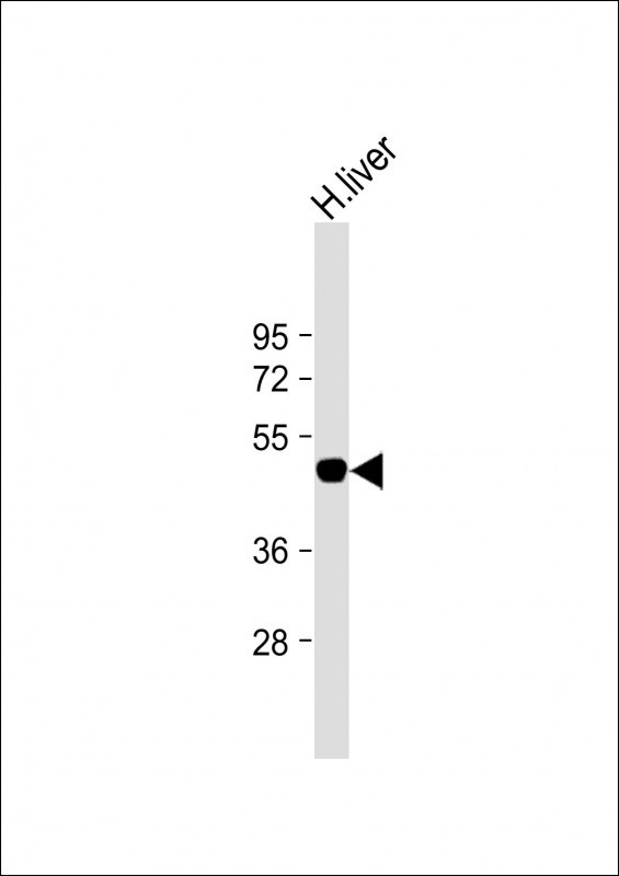 SLC39A14 (N-term)