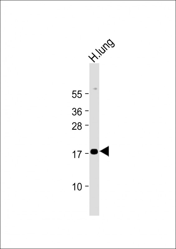 RARRES2 (N-Term)