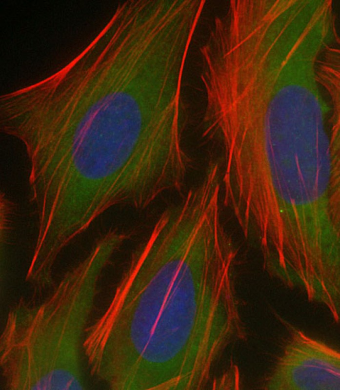 Rabbit Polyclonal Antibody to PKN1