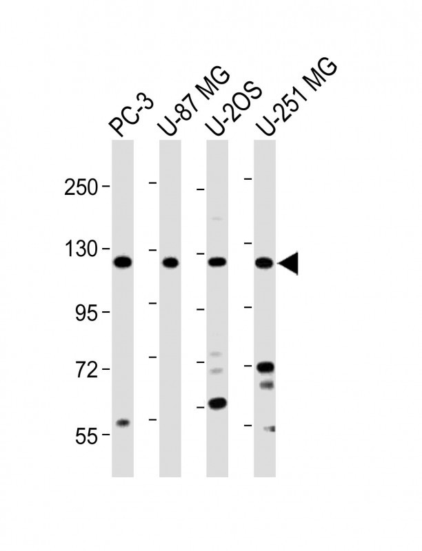 K0746 (N-term)