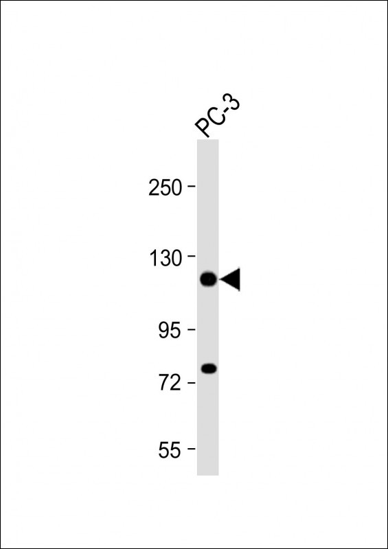 DSPP (N-term)