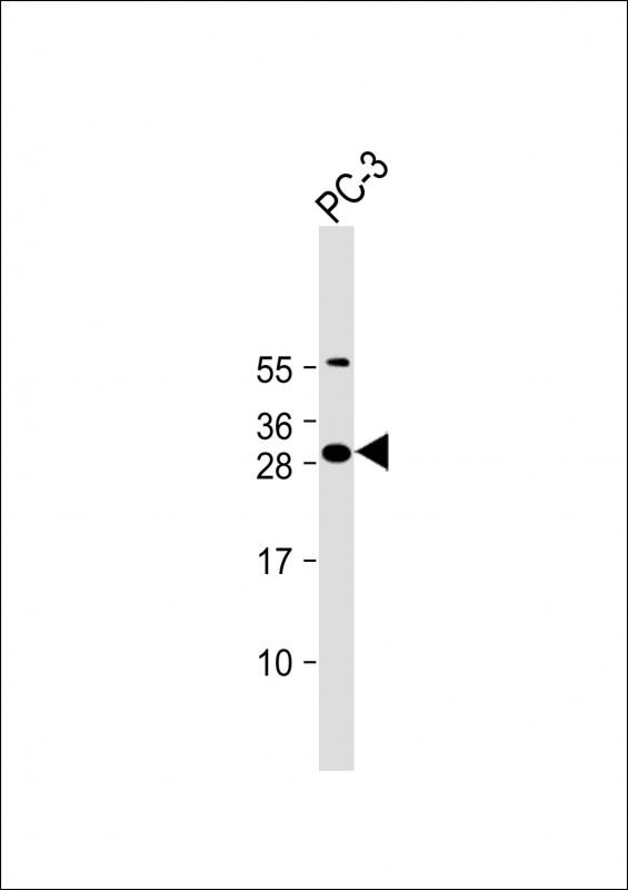 FAM125A (N-Term)