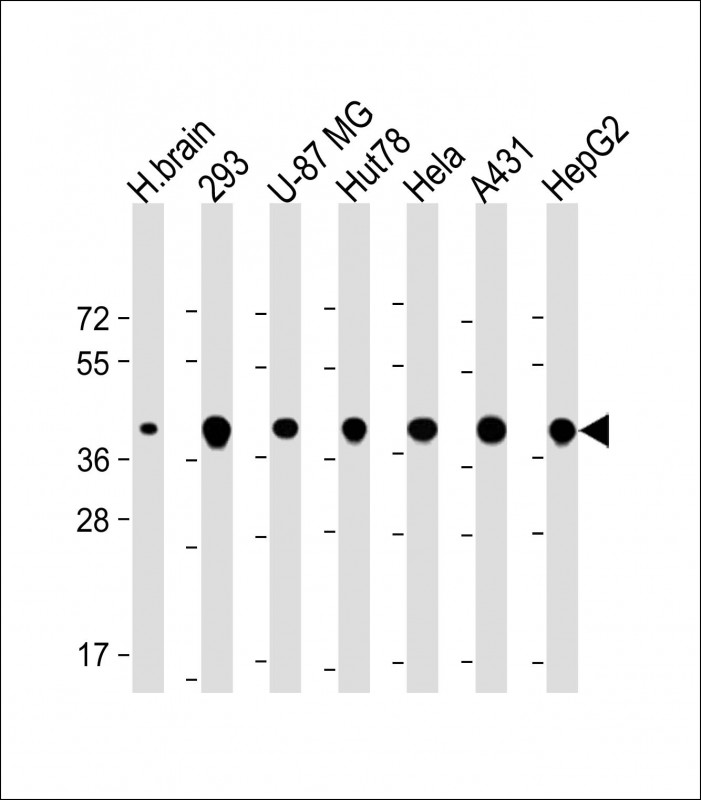 TOMM40 (N-Term)