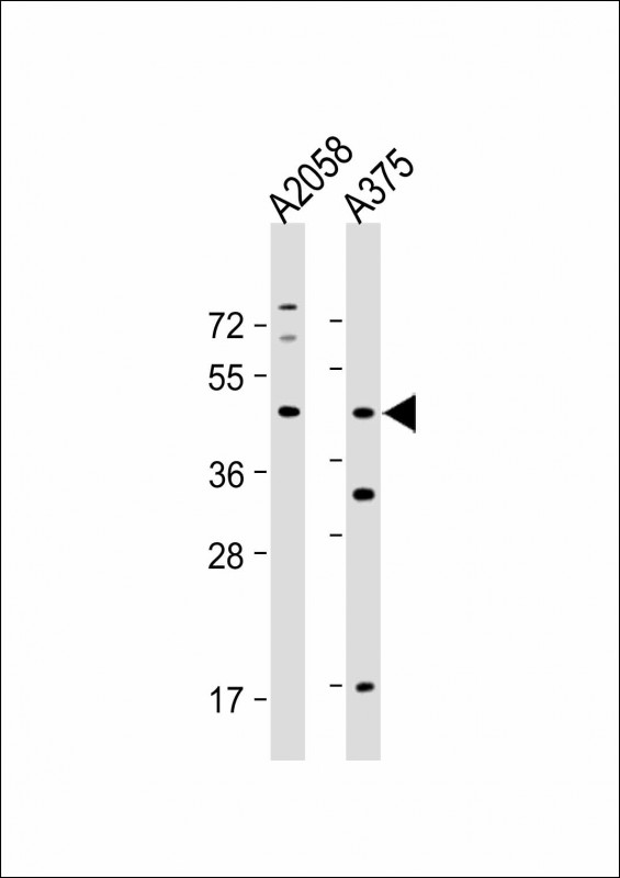 ST8SIA1 (N-Term)