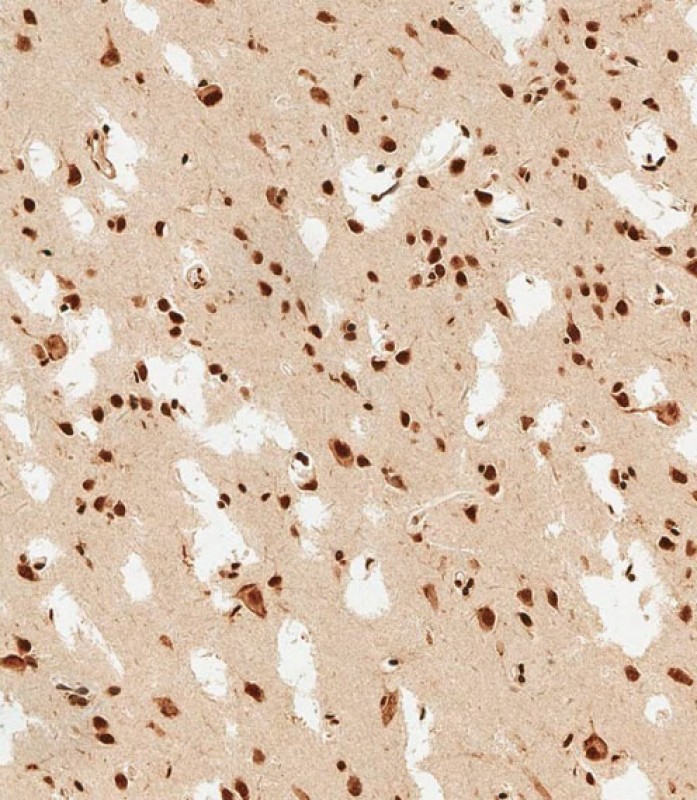 Rabbit Polyclonal Antibody to PSMD3