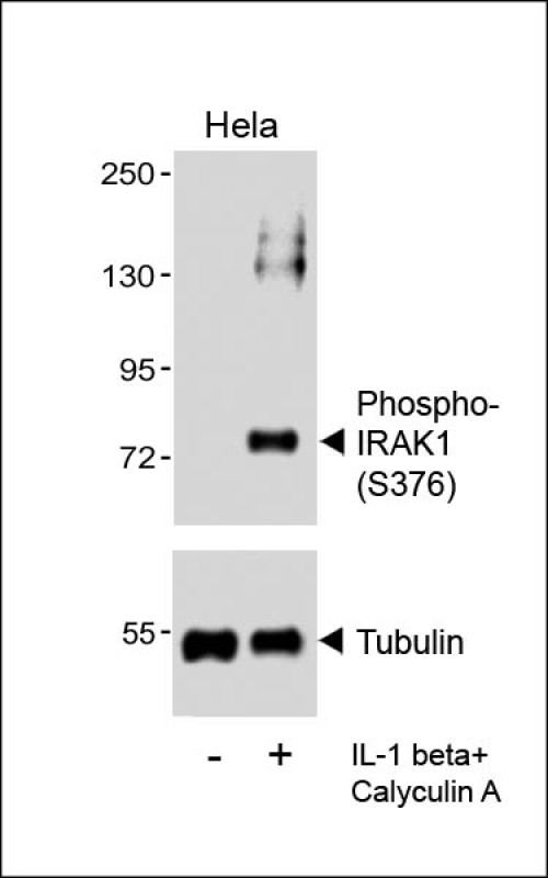 Phospho-IRAK1(S376)