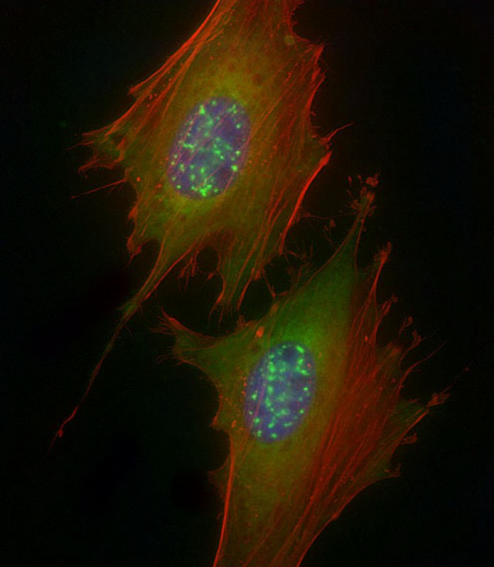 Rabbit Polyclonal Antibody to Phospho-IRAK1(S376)