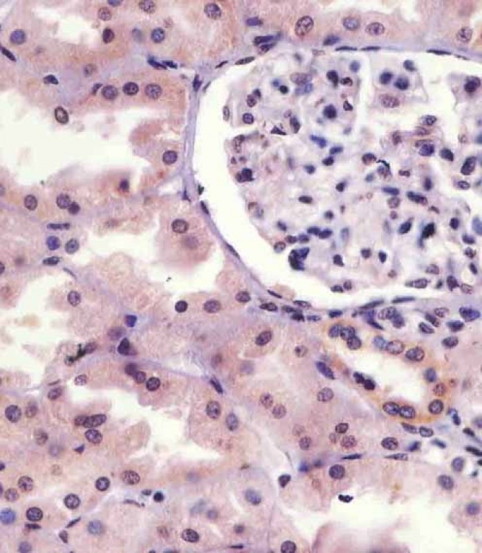 Rabbit Polyclonal Antibody to Phospho-IRAK1(S376)