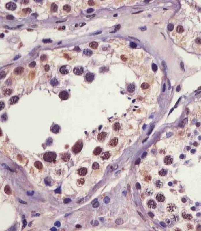 Rabbit Polyclonal Antibody to Phospho-IRAK1(S376)