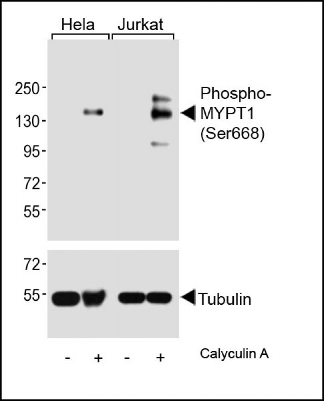 Phospho-MYPT1 (Ser668)