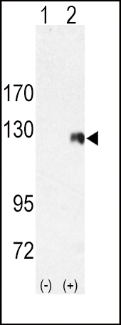 Rabbit Polyclonal Antibody to ROR2