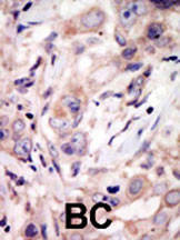 Rabbit Polyclonal Antibody to ROR2