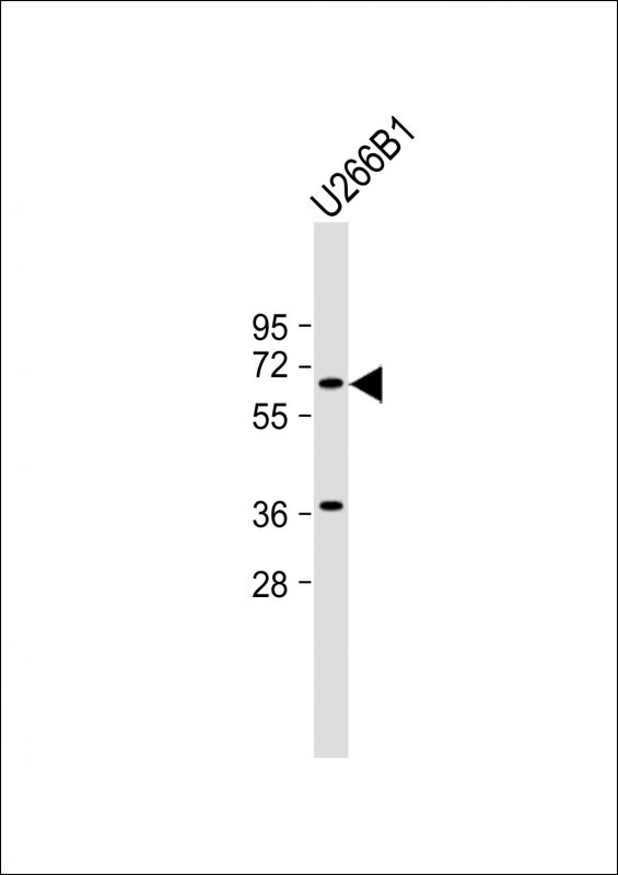 TXK (N-term)