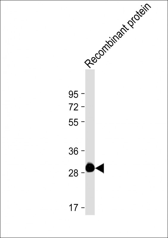 ROS1