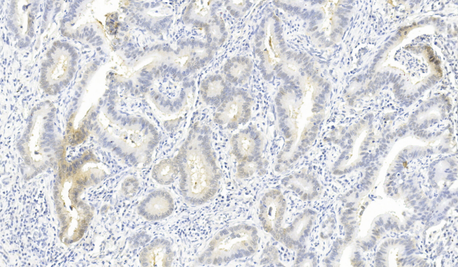 Mouse Monoclonal Antibody to ROS1