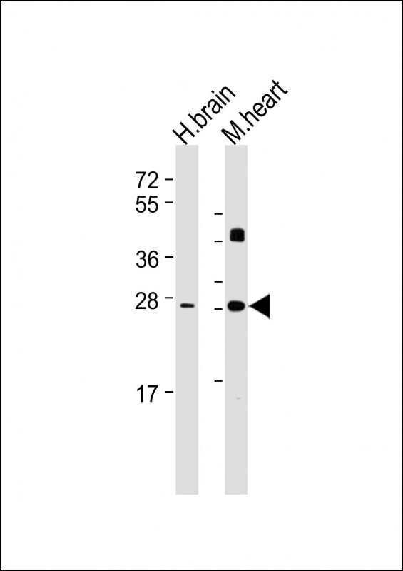 DKK2