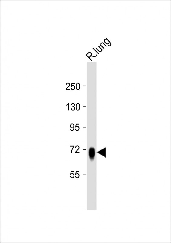 ST7