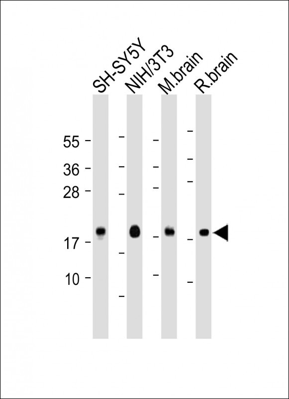 Rabbit Polyclonal Antibody to Calmodulin