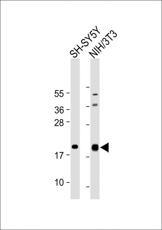 Rabbit Polyclonal Antibody to Calmodulin