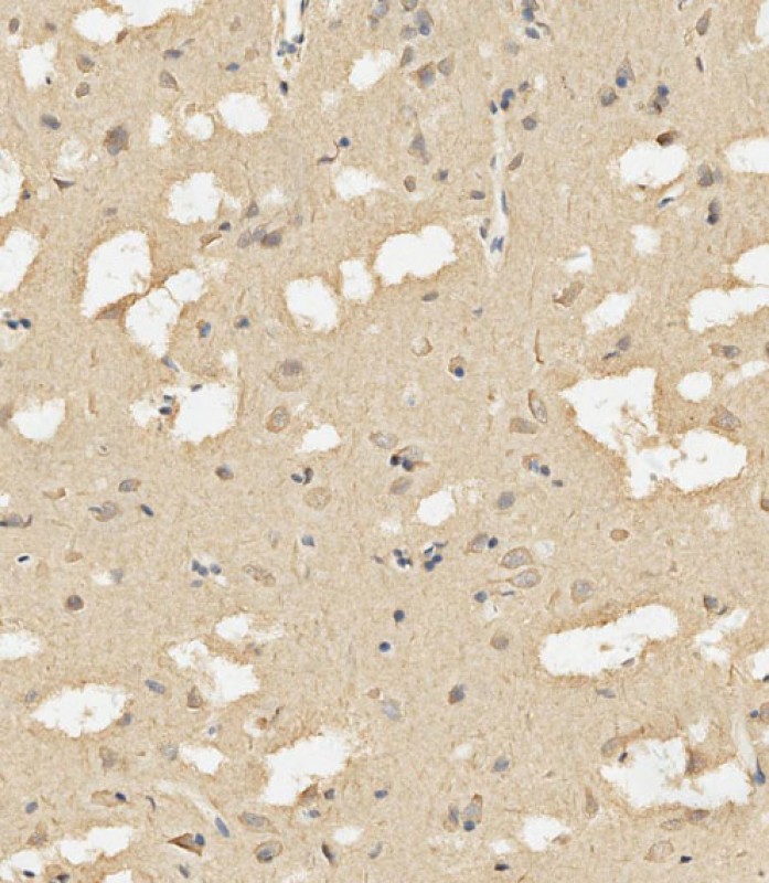 Rabbit Polyclonal Antibody to Calmodulin