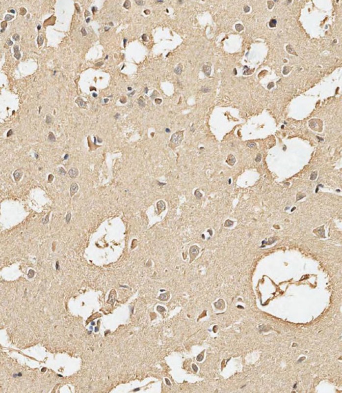 Rabbit Polyclonal Antibody to Calmodulin