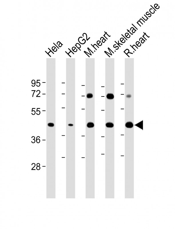 GYG1