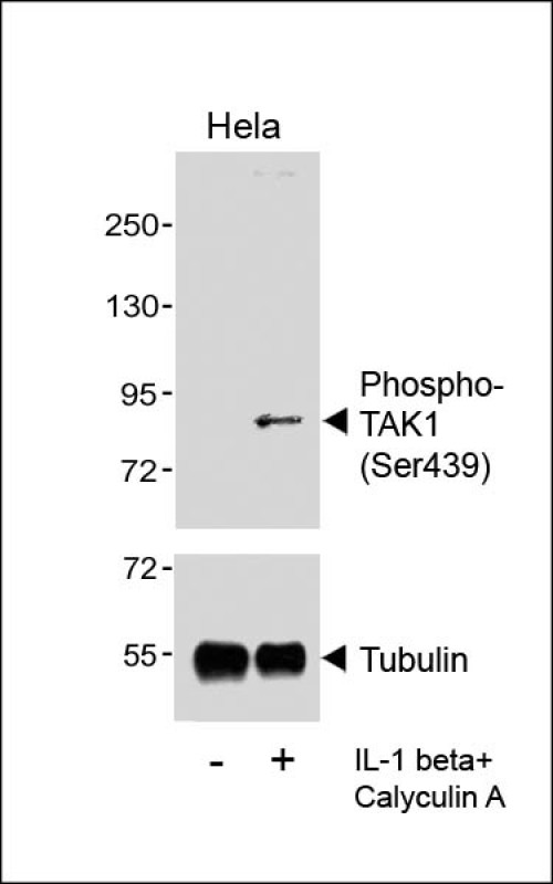 Phospho-TAK1 (Ser439)