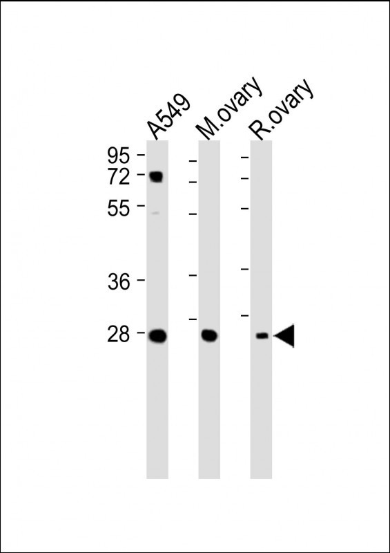 IGFBP4 (N-term)