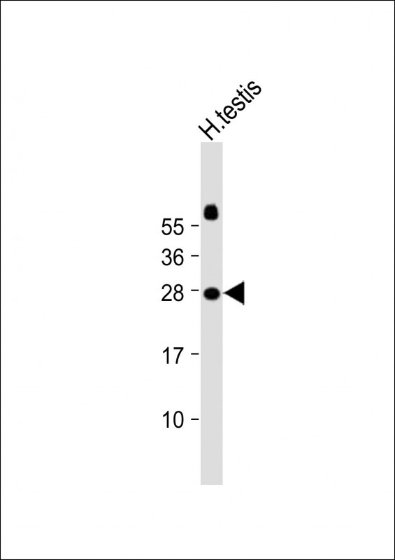 JAZF1 (N-term)