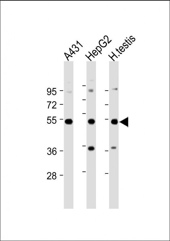 STK25