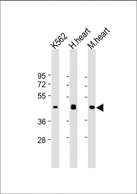 PDK4