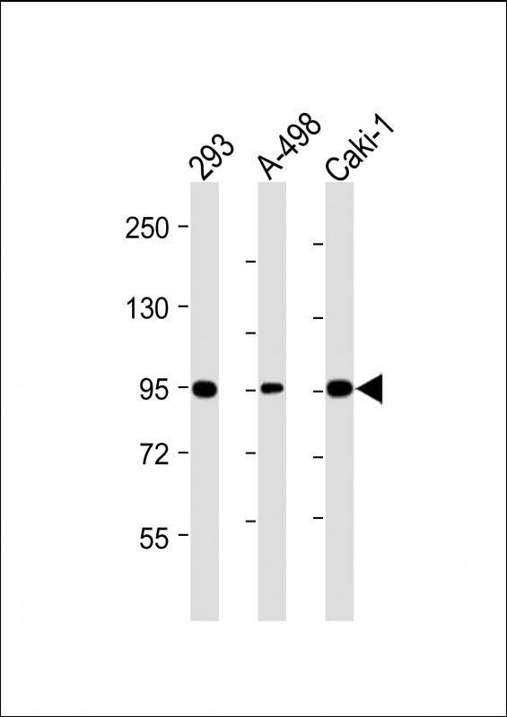 Nephrin (Y1210)