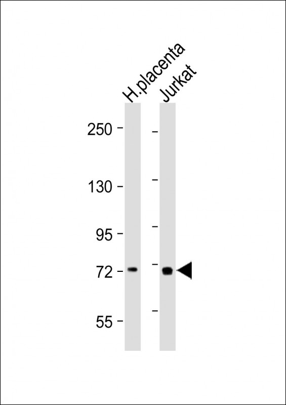 TAP2 (N-Term)
