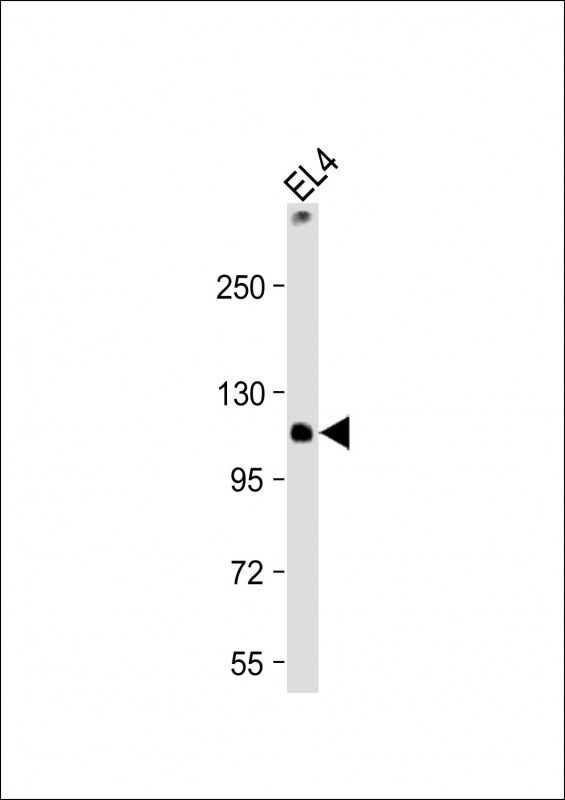 TCIRG1