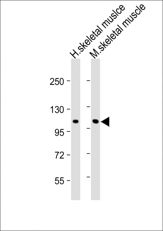 CLCN1 (N-Term)