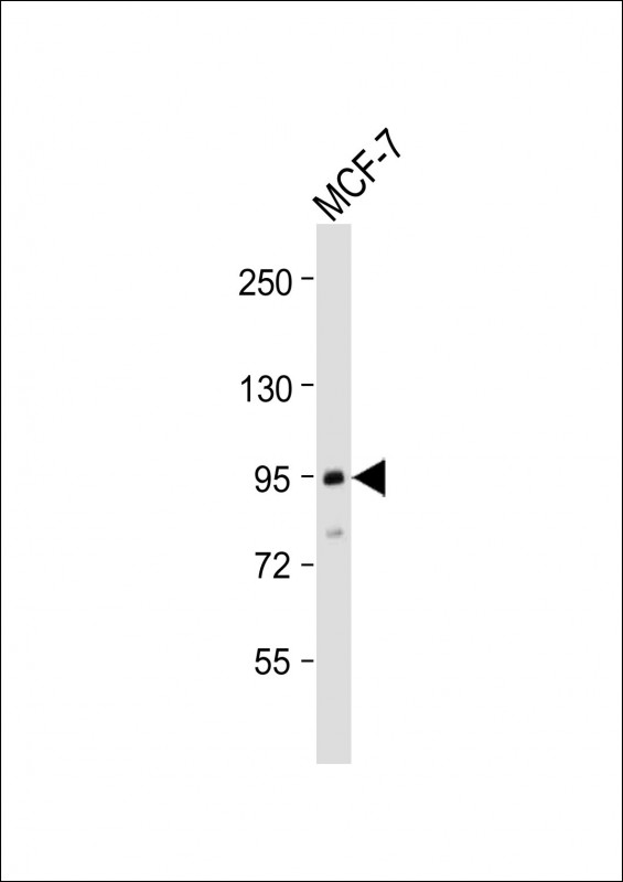 TGFBR3 (N-Term)