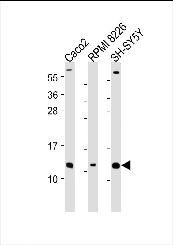CKS2 (N-Term)