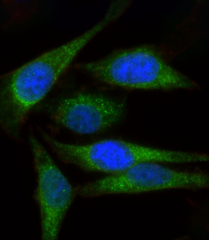 Rabbit Polyclonal Antibody to MYL1