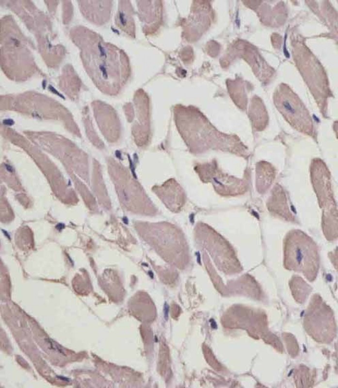 Rabbit Polyclonal Antibody to MYL1