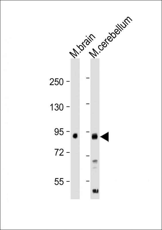 LINGO-1(LRRN6A)-S596 (C-term)
